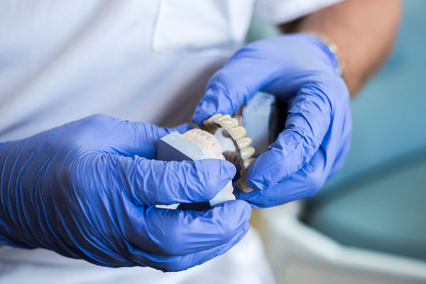Eine Zahnprothese für den Oberkiefer wird am Gipsbodell geprüft